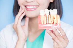 Ashburn dentist, dental implants ashburn